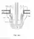Fig. 33 - Trocar and wound closure device