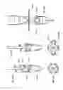 Fig. 47 - Trocar and wound closure device