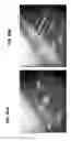Fig. 50 - Trocar and wound closure device