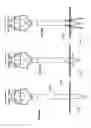 Fig. 52 - Trocar and wound closure device