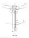 Fig. 15 - SYSTEM AND METHOD FOR TRANSAPICAL ACCESS AND CLOSURE