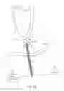 Fig. 32 - SYSTEM AND METHOD FOR TRANSAPICAL ACCESS AND CLOSURE