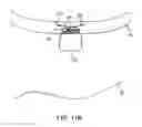 Fig. 45 - SYSTEM AND METHOD FOR TRANSAPICAL ACCESS AND CLOSURE