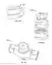 Fig. 09 - Mini-rail external fixator