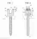 Fig. 02 - Bone anchors