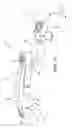 Fig. 02 - Transconnector for Coupling First and Second Spinal Fixation Elements