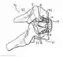 Fig. 01 - Interbody device and plate for spinal stabilization and instruments for positioning same