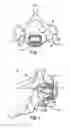 Fig. 02 - Interbody device and plate for spinal stabilization and instruments for positioning same