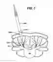 Fig. 10 - Methods and devices for minimally invasive spinal fixation element placement