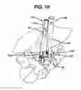 Fig. 13 - Methods and devices for minimally invasive spinal fixation element placement