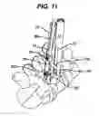 Fig. 14 - Methods and devices for minimally invasive spinal fixation element placement