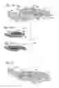 Fig. 12 - Bone plate with movable joint