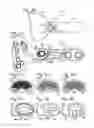 Fig. 13 - Bone plate with movable joint