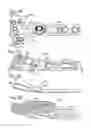 Fig. 14 - Bone plate with movable joint