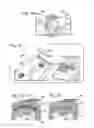 Fig. 20 - Bone plate with movable joint