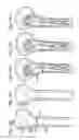 Fig. 31 - Bone plate with movable joint