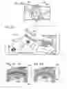 Fig. 20 - Bone plate with movable joint
