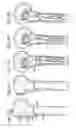 Fig. 31 - Bone plate with movable joint