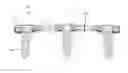 Fig. 01 - Bone anchor locking device