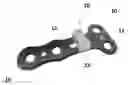 Fig. 01 - Bone plate with attachable wedge