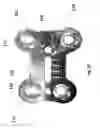 Fig. 04 - Bone plate with attachable wedge