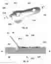 Fig. 05 - Bone plate with attachable wedge