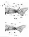 Fig. 22 - Bone plate with attachable wedge