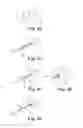 Fig. 05 - Sacroiliac joint fusion screw and method