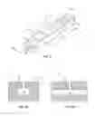 Fig. 08 - Composite Metal and Bone Orthopedic Fixation Devices