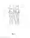 Fig. 07 - Anchoring systems and methods for surgery