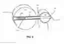 Fig. 09 - Anchoring systems and methods for surgery