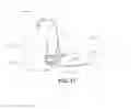 Fig. 16 - Anchoring systems and methods for surgery