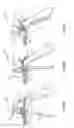 Fig. 04 - Valve control mechanism and method