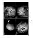 Fig. 02 - System and method for dynamic validation, correction of registration for surgical navigation