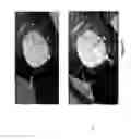 Fig. 06 - System and method for dynamic validation, correction of registration for surgical navigation