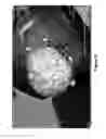 Fig. 07 - System and method for dynamic validation, correction of registration for surgical navigation