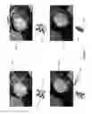 Fig. 08 - System and method for dynamic validation, correction of registration for surgical navigation