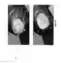 Fig. 09 - System and method for dynamic validation, correction of registration for surgical navigation
