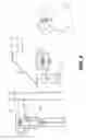 Fig. 03 - Partial surgical guide
