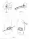 Fig. 04 - Devices, systems, and methods for orthodontic hardware