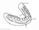 Fig. 01 - Removable system and method for dentures and surgical guides