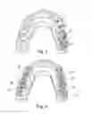 Fig. 04 - Method for constructing tooth surfaces of a dental prosthesis and for producing dental restorations
