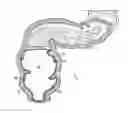 Fig. 01 - METHODS FOR TREATING DISEASES OF THE COLON