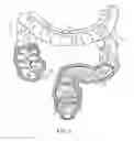 Fig. 02 - METHODS FOR TREATING DISEASES OF THE COLON