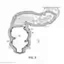 Fig. 08 - METHODS FOR TREATING DISEASES OF THE COLON