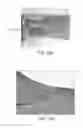 Fig. 13 - METHODS FOR TREATING DISEASES OF THE COLON