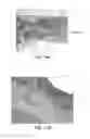 Fig. 15 - METHODS FOR TREATING DISEASES OF THE COLON