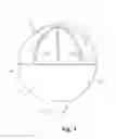 Fig. 02 - Orthotopic artificial bladder endoprosthesis