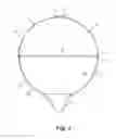 Fig. 03 - Orthotopic artificial bladder endoprosthesis