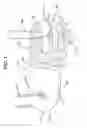 Fig. 02 - Flipping-type graft fixation device and method with low flipping distance